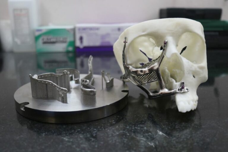 IIT Madras develops 3D printed face implants