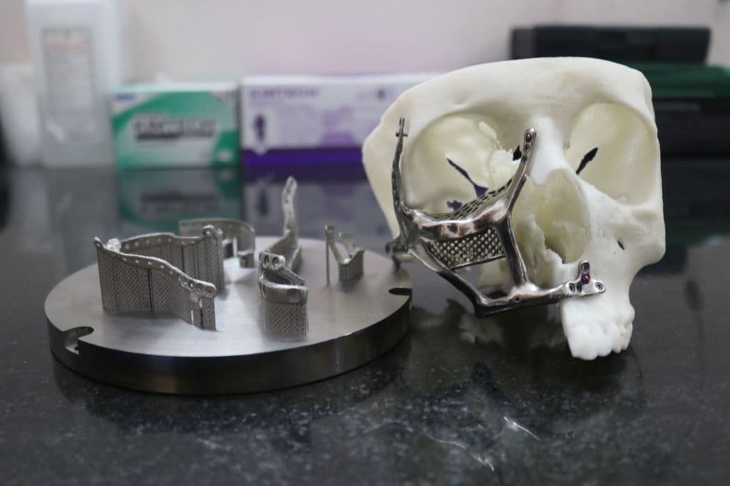 IIT Madras develops 3D printed face implants IIT Madras develops 3D printed face implants